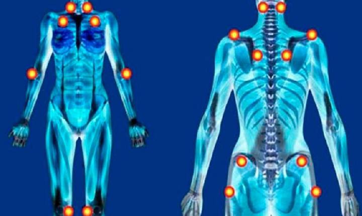 Leis ampliam direitos e garantias às pessoas com fibromialgia no Paraná e no Brasil