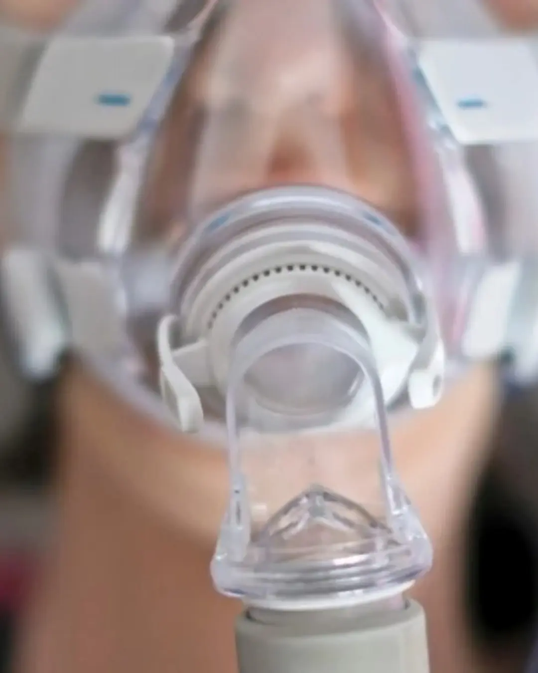 MPPR e Sesa firmam acordo para zerar fila de espera por respiradores e CPAPs no Paraná