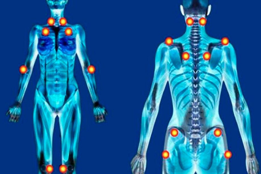 Leis ampliam direitos e garantias às pessoas com fibromialgia no Paraná e no Brasil